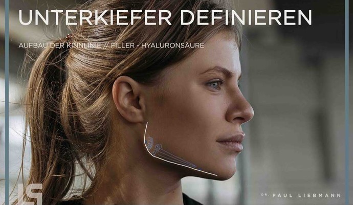 Jawlineınız var mı?