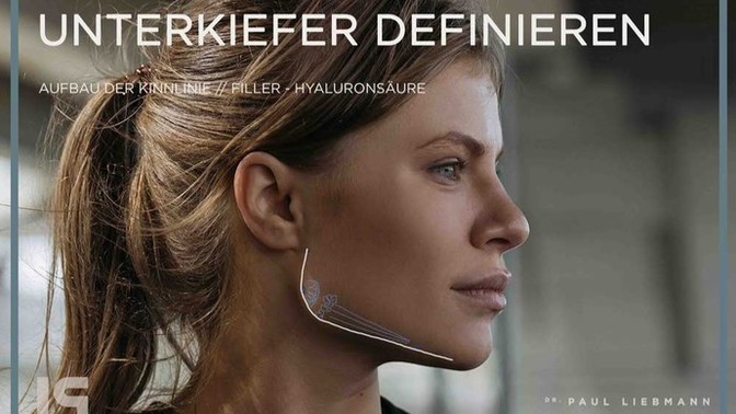 Jawline'ınız var mı?