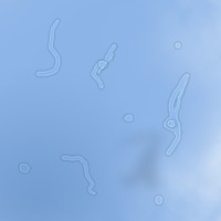 Bir şey soracağım gözümde zikzaklı şekiller dönüyor?