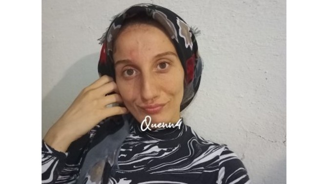 Sineklerden nefret ediyor musunuz?