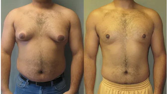 Erkeklerin hormonlarımı bozuluyor?