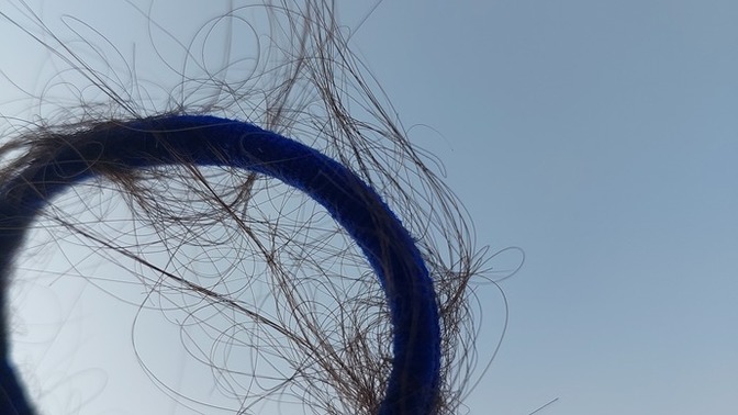 Saçlarım dökülüyor gençken çok gürdü?