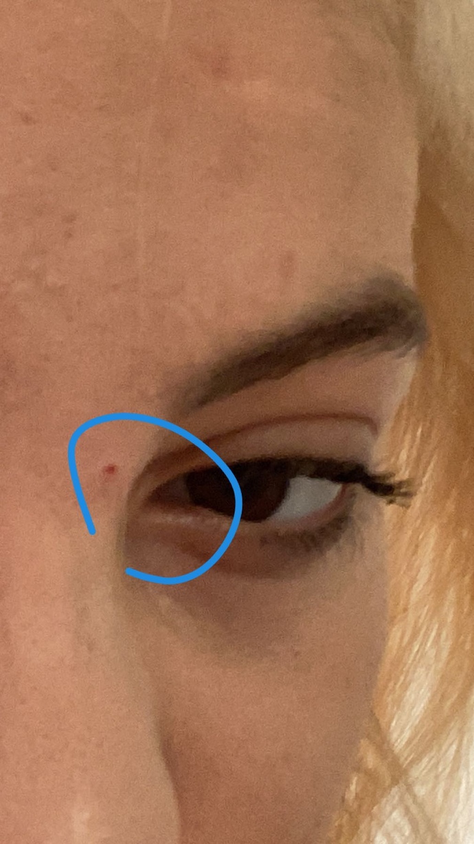 20-30 kat fondoten sürdüm yine de kapanmıyor lanet şey ve çok kötü duruyor ne yapacağım?