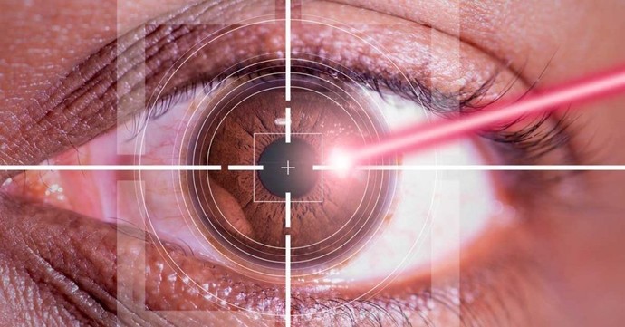 Lazer (göz çizdirme) için belirli bir yaş sınırı var mı?