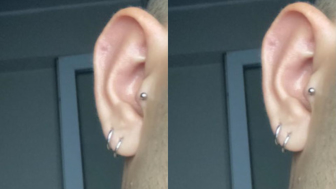 Bugün tragus yaptım. Diğer küpelerle hoş duruyor mu?