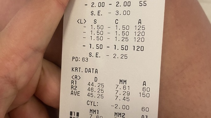 Göz numaralarım ne?
