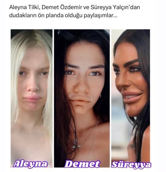 Estetikli dudaklar çok mu itici gözüküyor?