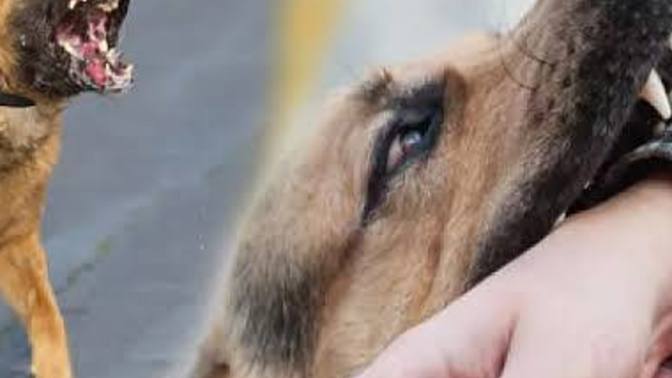 Hiç köpek saldırısına maruz kaldınız mı?