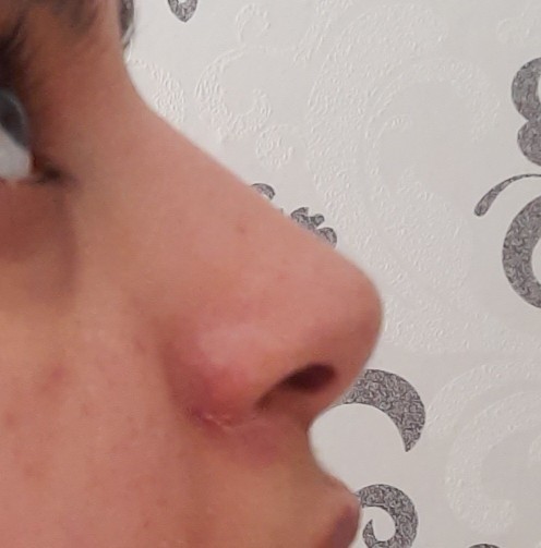 Sizce de burnum estetikli gibi değil mi?