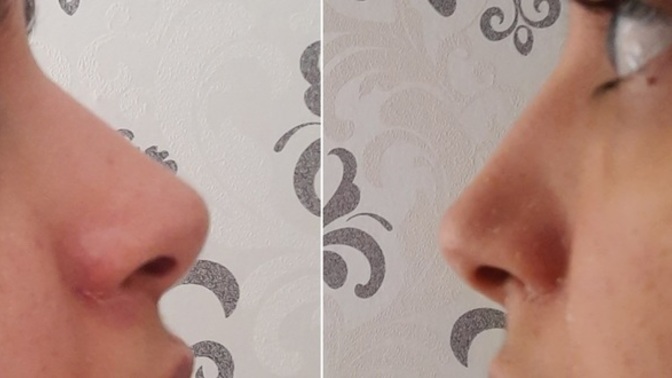 Sizce de burnum estetikli gibi değil mi?