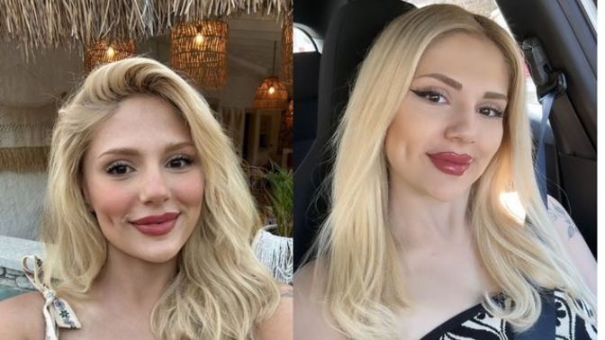 Gamze tek yanakta mı iki yanakta mı güzel?