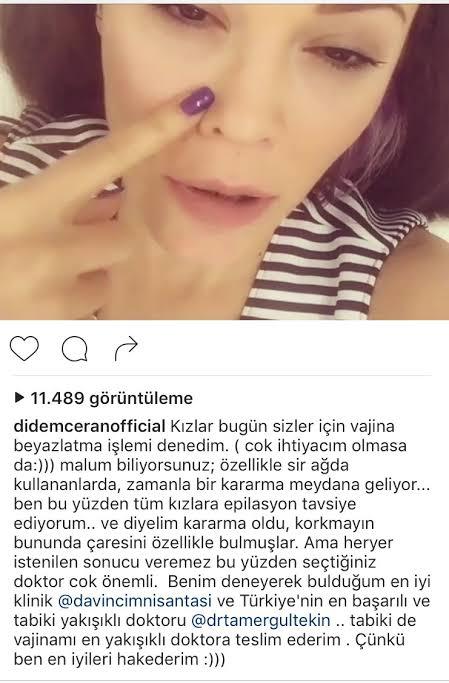 Skandalı hatırlayalım xd