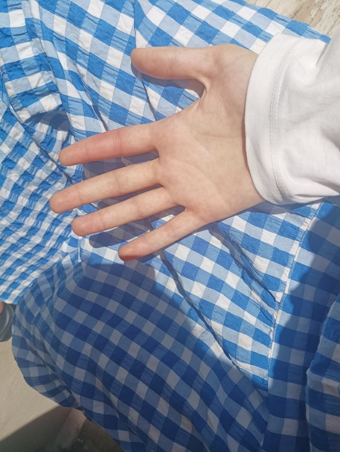 Arının iğnesini batırdığı yer neden kaşınır?