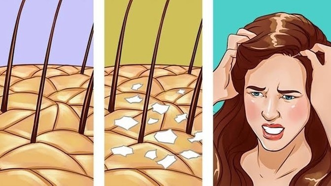 Banyo ettiğim gün içinde saçım neden kaşınmaya başlıyor?