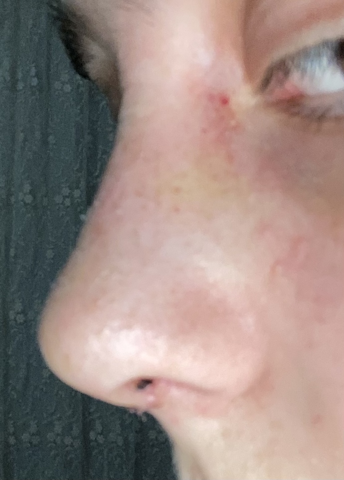 Ark burun ucum kalkık mı duruyor?
