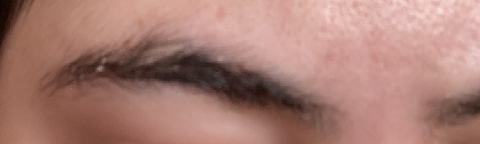 Kaşlarım çok döküldü, niye acaba?