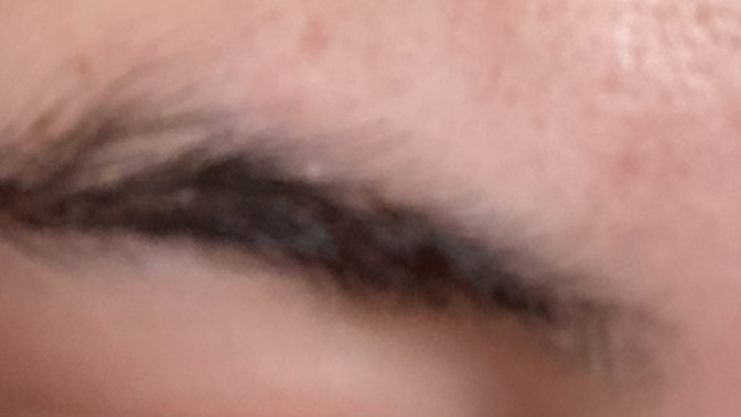 Kaşlarım çok döküldü, niye acaba?