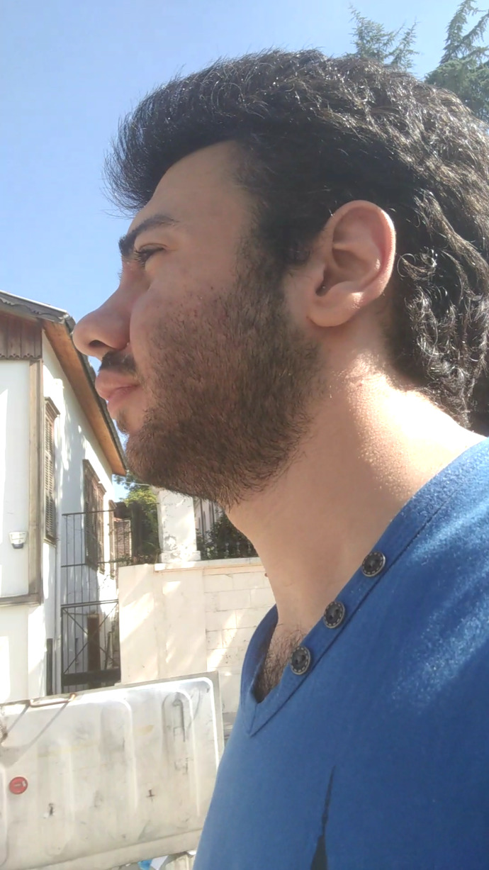 Jawline yaptirmali miyim?