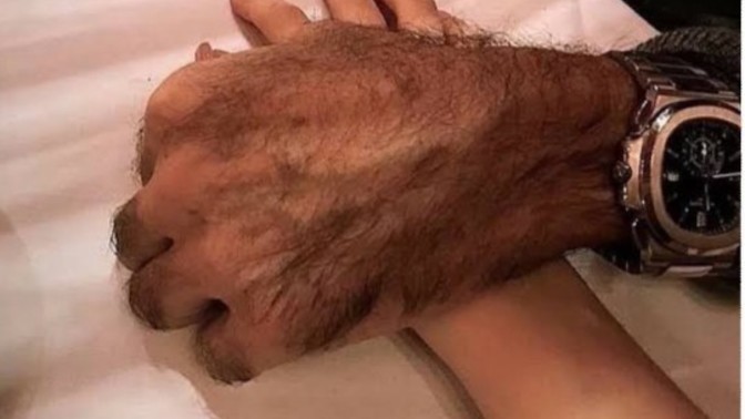 Erkekler el parmak tüylerine ağda yapmalı mı?