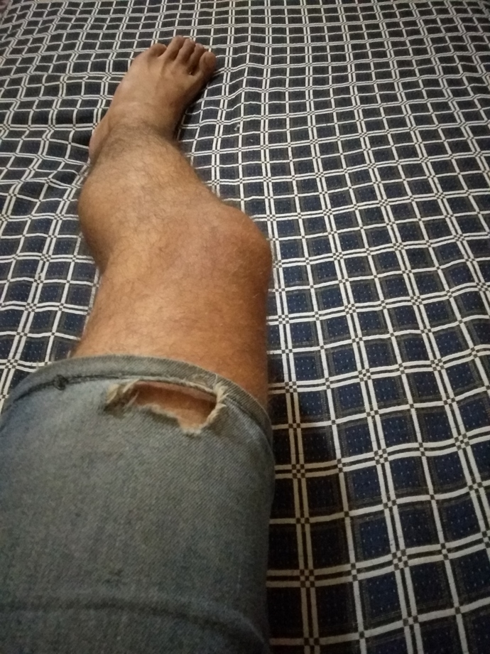 Kızlar, Şortum nasıl?