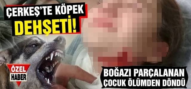 Hayvanseverler neden bir çocuğa köpek saldırınca ses çıkarmıyor?