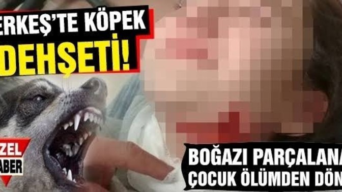 Hayvanseverler neden bir çocuğa köpek saldırınca ses çıkarmıyor?