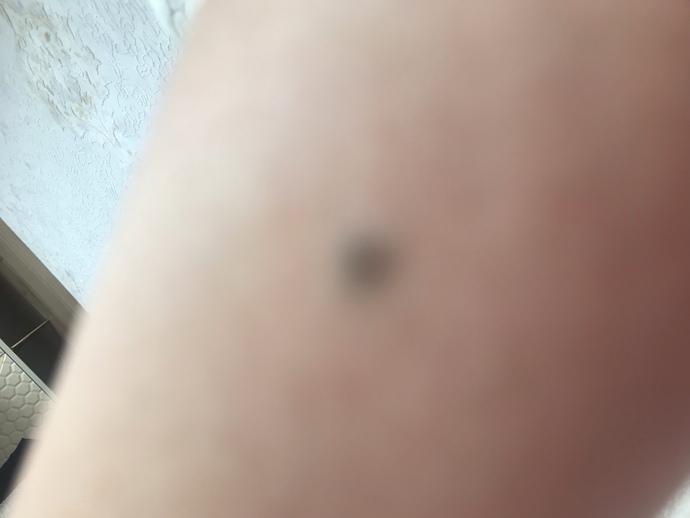Koluma kalem izi var hostes olabilir miyim?