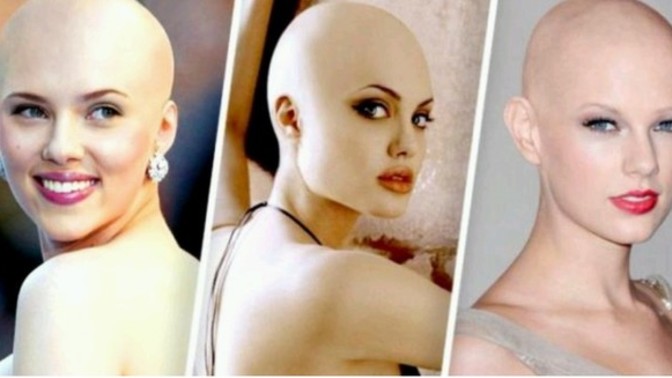 Kadınlara kel olmak bile yakışır mı?