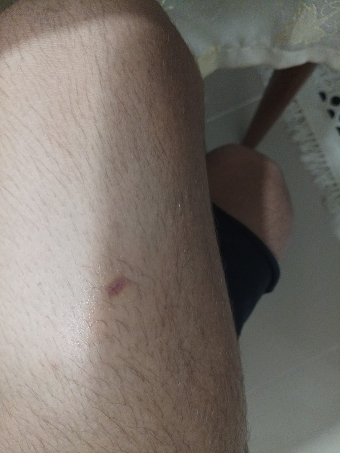 Bu Yara Kapanmış mı?