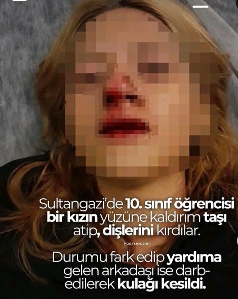 10. Sınıf kız çocuğuna kaldırım taşıyla saldırıp dişleri kırıldı yardıma gelen arkadaşının kulağı kesildi emniyet nerede?