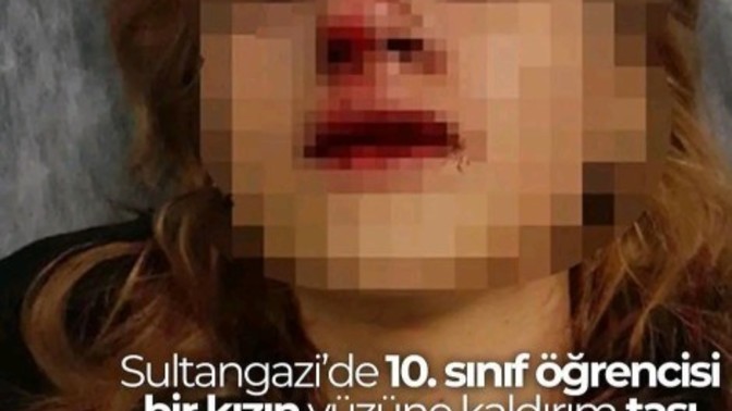 10. Sınıf kız çocuğuna kaldırım taşıyla saldırıp dişleri kırıldı yardıma gelen arkadaşının kulağı kesildi emniyet nerede?