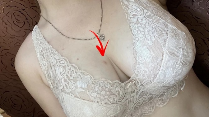 Şuramda leke gibi birşey oluştu, nedir bu, nasıl geçer?