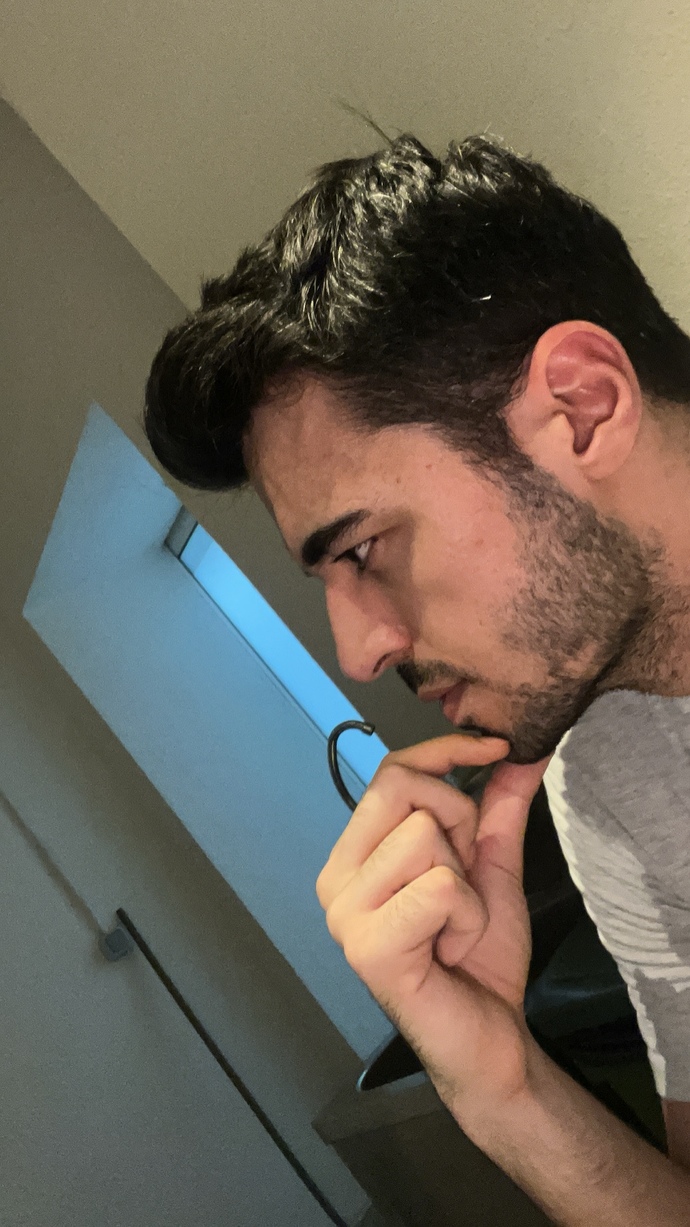 Elmacık kemiklerim belirginleşti ne yapabilirim?