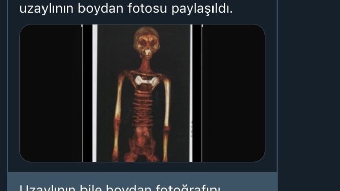 Konuştuğumuz insandan fotoğraf istemek gereksiz bir olay mı gerekli mi?