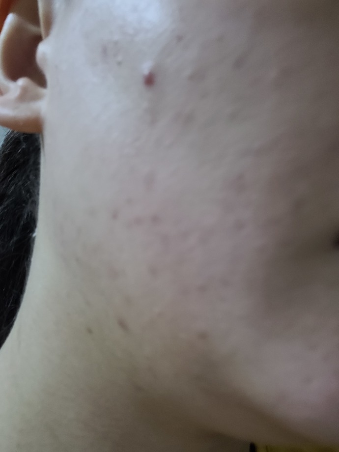 Depresyon bir fotoğraf olsaydı neleri gösterirdiniz?