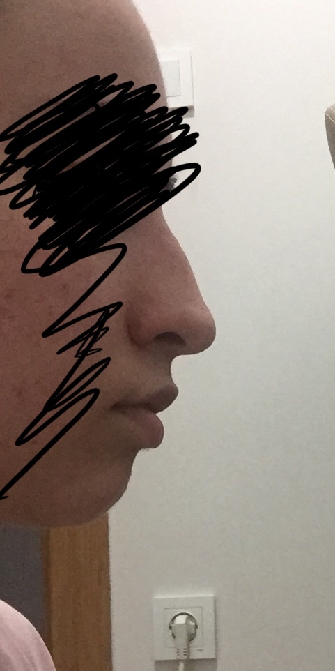 Sizce bu buruna estetik gerekiyor mu?