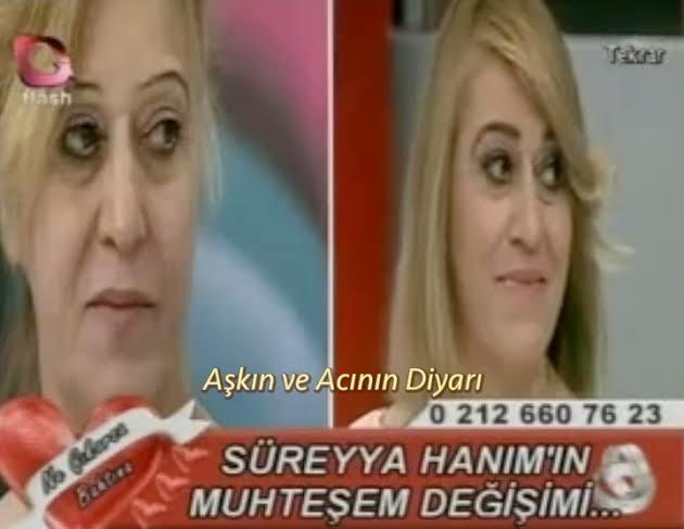 Estetikli halim daha güzel olmaz mıydı?