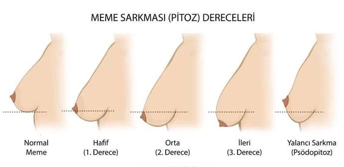 Bunlarda şekilleri sence hangisi senin durum?
