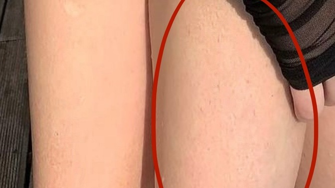 Yeni çıkan bacak tüyleri itici mi?
