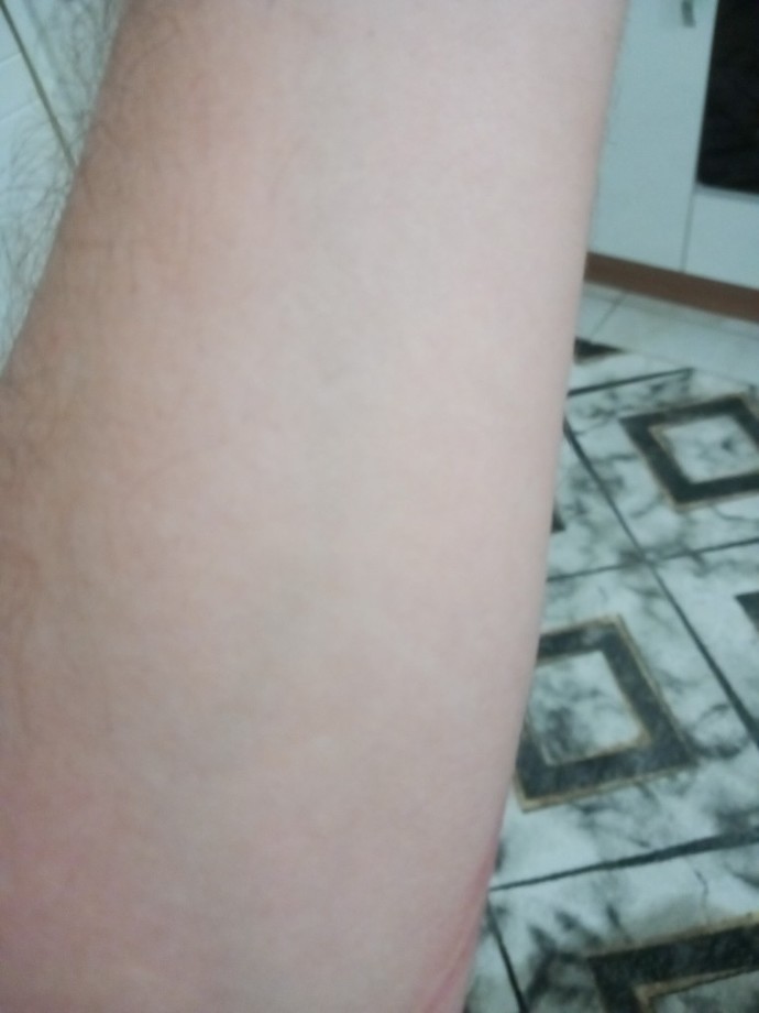 Çok fazla beyaz tenli olmak kötü mü?