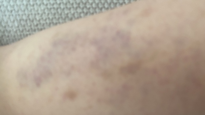 Şu koluma Dalin yağı sürüyorum, iyi gelir mi?