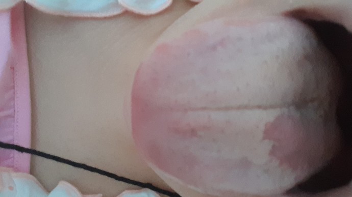 Dilim aşırı kuru ve boğazım ağrıyor, yara oldu. Yaşayan var mı ?