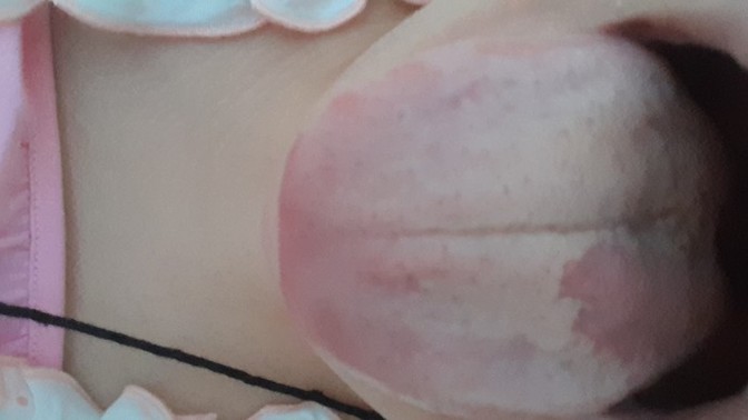 Dilim aşırı kuru ve boğazım ağrıyor, yara oldu. Yaşayan var mı ?