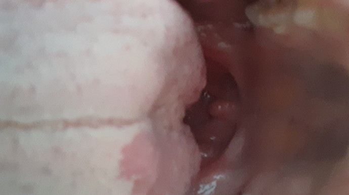 Midesi bulanan bakmasın ikidir dokta gidiyorum dilim beyaz tükürük yok ağzım kuruyo yara midem bulanıyo yaşayan var mı  korkuyorum?