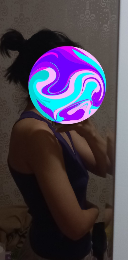 Duruş bozukluğum var gibi mi duruyor? Ortopediye mi gitmeliyim?