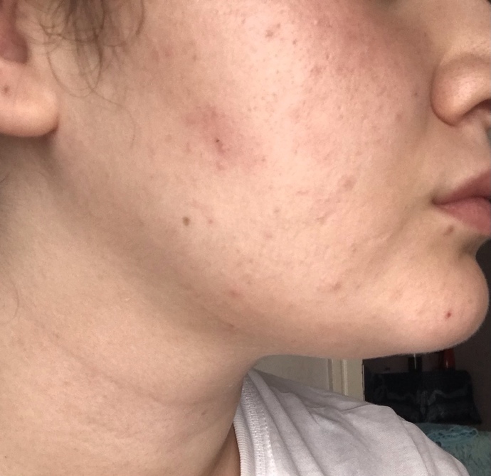Gua Sha sizce etkili mi?
