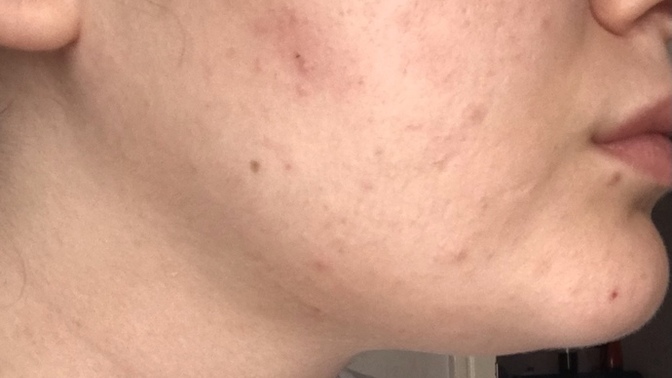 Gua Sha sizce etkili mi?