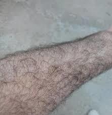 Kollarımda kıl var, erkekler bunu takar mı?