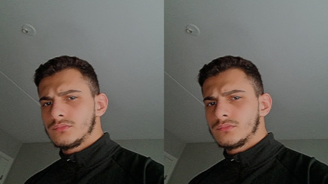 Sakal gürleştiren serum ne kullanabilirim?
