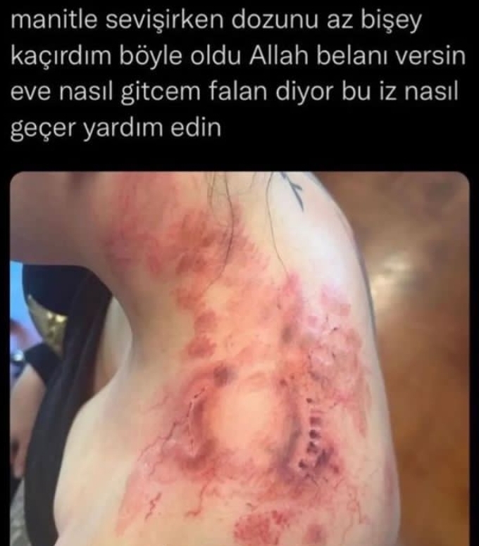 Cinsellikte şiddetin dozu nasıl ayarlanmalı?